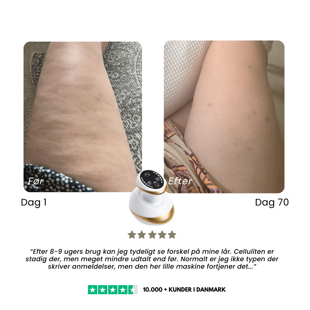 CelluSmooth™ - Anti cellulite massageapparat