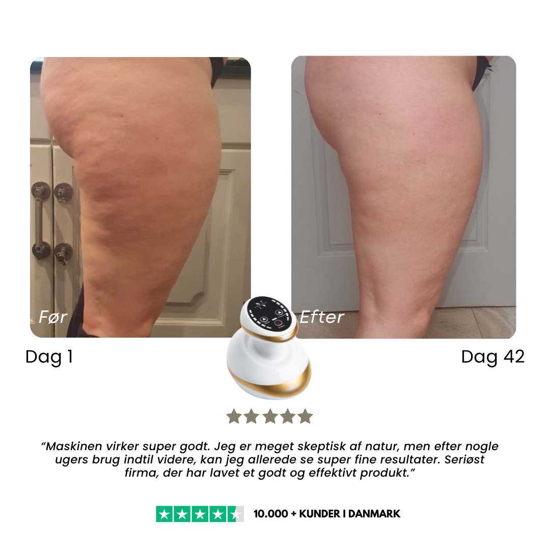 CelluSmooth™ Bundle